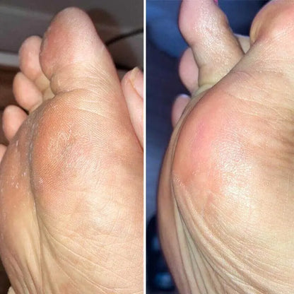 OMNX Silk 3 Pro | Electric Callus Remover — Silky Smooth Feet in Minutes