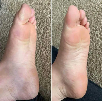 OMNX Silk 3 Pro | Electric Callus Remover — Silky Smooth Feet in Minutes