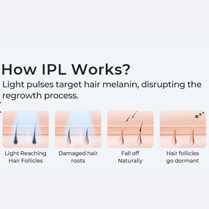 IPL Laser Hair Removal Device