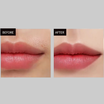 IPL Laser Hair Removal Device