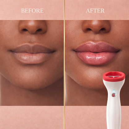 Fuller Lip Plumper Device