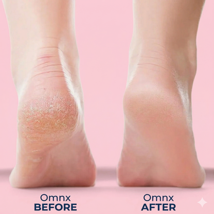 OMNX Silk 3 Pro | Electric Callus Remover — Silky Smooth Feet in Minutes