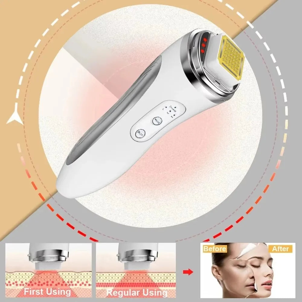 OMNX Dot & Aqualis Activator