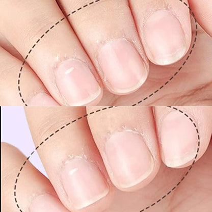 Nail Cuticle Oil Pen — Cuticle Revitalizer & Nail Nourishment Care Pen