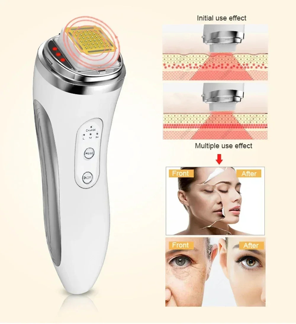 OMNX Dot & Aqualis Activator