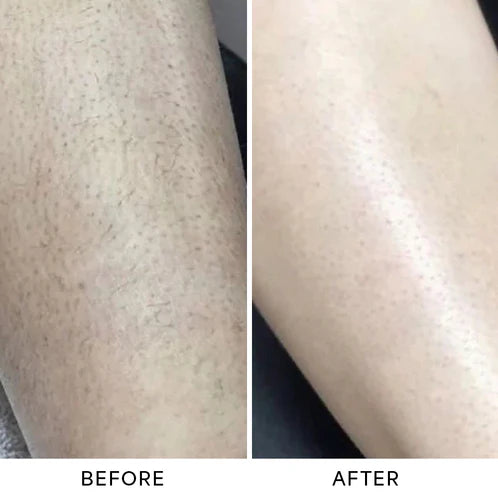 OMNX Silk Duo | 2-in-1 Hair Remover & Shaver — Legs, Underarms, Face & Bikini Line. Smooth for Weeks.