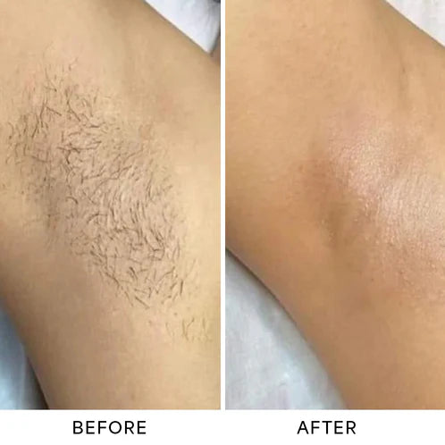 OMNX Silk Duo | 2-in-1 Hair Remover & Shaver — Legs, Underarms, Face & Bikini Line. Smooth for Weeks.