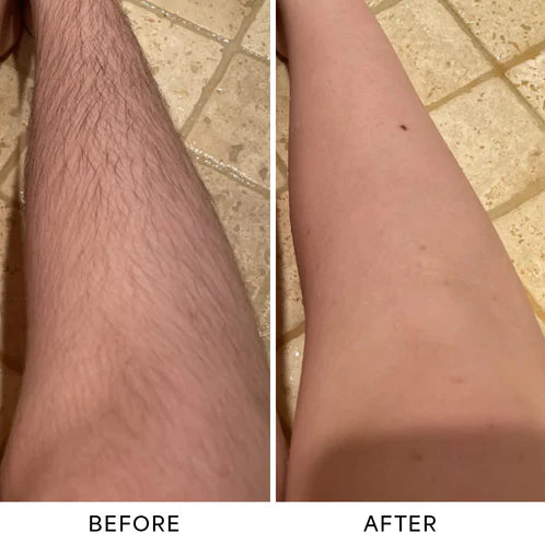 OMNX Silk Duo | 2-in-1 Hair Remover & Shaver — Legs, Underarms, Face & Bikini Line. Smooth for Weeks.
