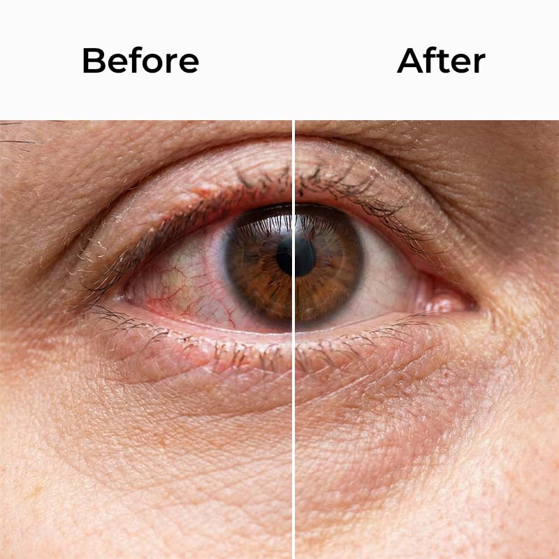 OMNX Eye Mist Relief