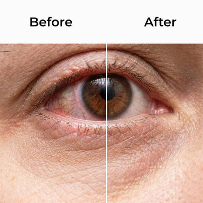 OMNX Eye Mist Relief