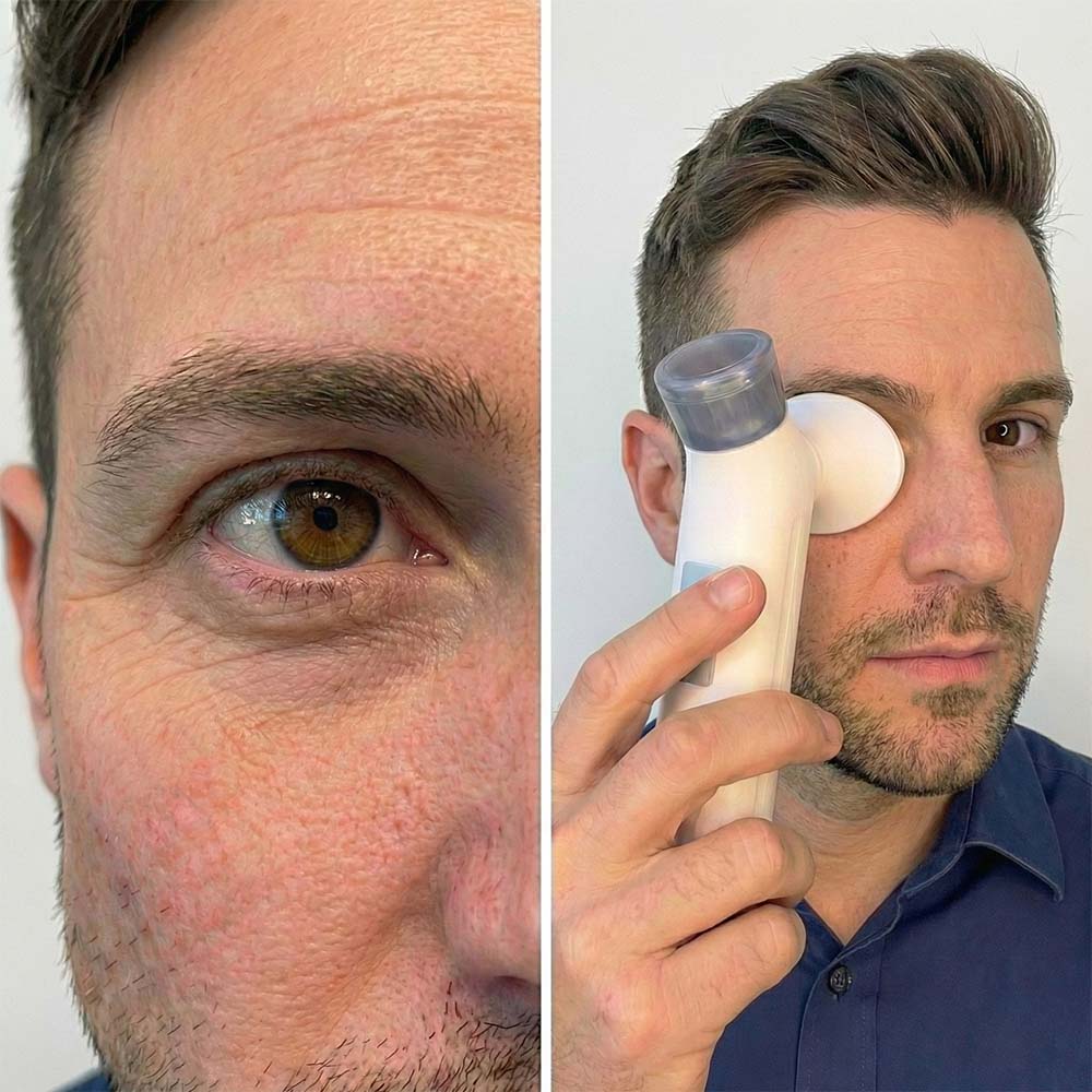OMNX Eye Mist Relief